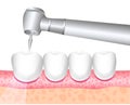 The tool of the dentist. Dental treatment, dentistry. Drills. The treatment of toothaches, drilling teeth. Vector illustration Royalty Free Stock Photo